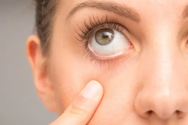 Que és y Causas Tic del Ojo Que és y Causas Tic del Ojo