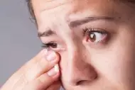 Síntomas y Tratamiento: Conjuntivitis