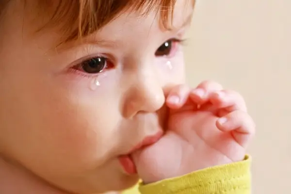 Conjuntivitis en recién nascidos y niños Conjuntivitis en recién nascidos y niños