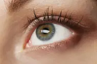 Queratitis: lesiones oculares