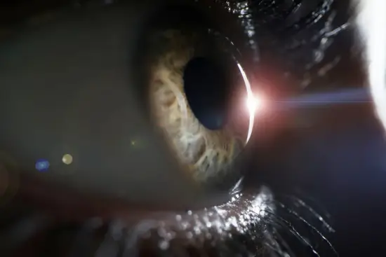 Degeneración macular en los ojos Degeneración macular en los ojos