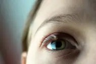 Orzuelo en el ojo