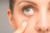 Tic del ojo: Causas