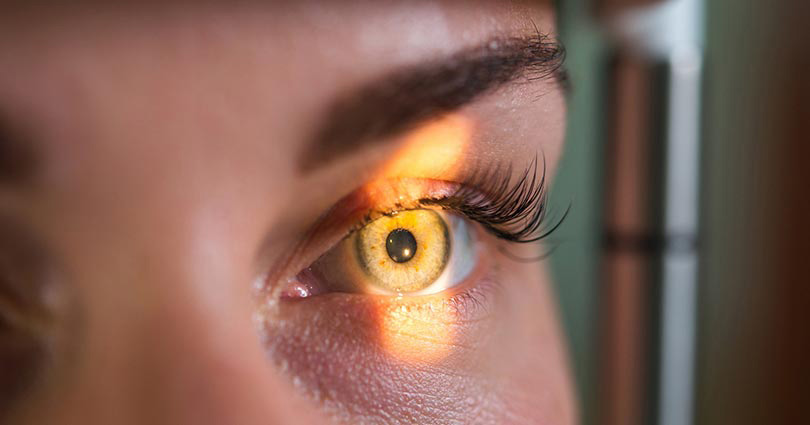 Enfermedades oculares raras: descubre algunas