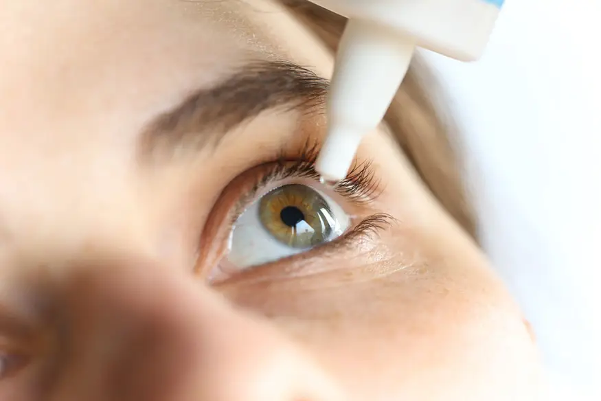 Artritis reumatoide (AR): Ojo seco Artritis reumatoide (AR): Ojo seco