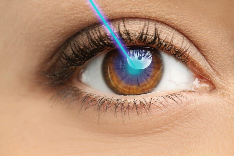 Cirugía láser para tratar las enfermedades oculares