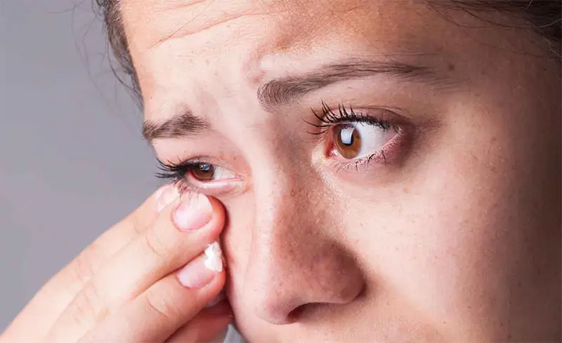 Conjuntivitis: Síntomas y Tratamiento 