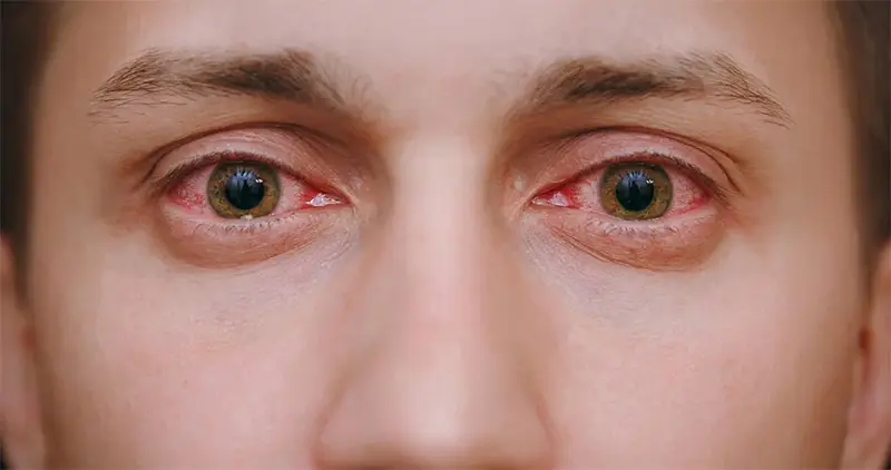 Ojos rojos con lentes de contacto cheap