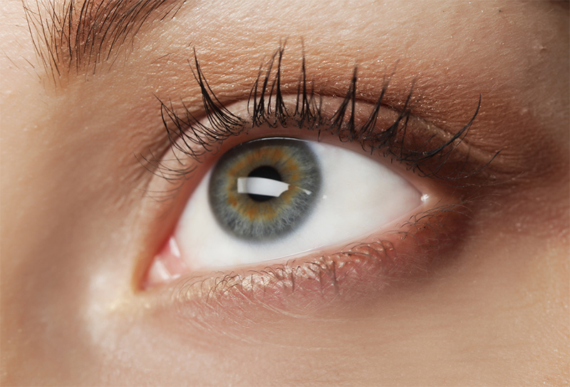 Queratitis:lesiones oculares