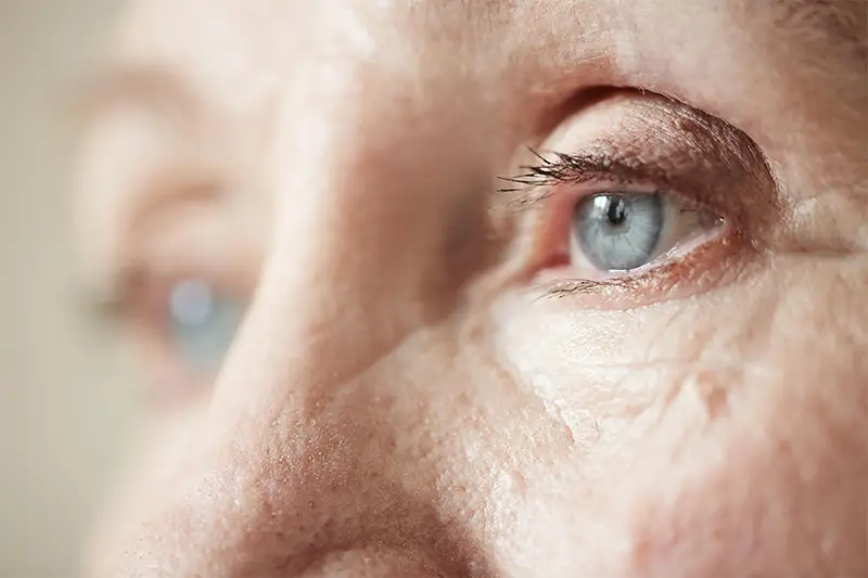 Degeneración macular en los ojos Degeneración macular en los ojos