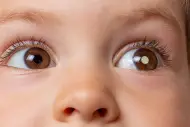 Retinoblastoma: qué es, síntomas y tratamiento