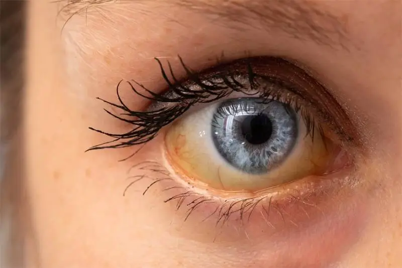 Ojos amarillos