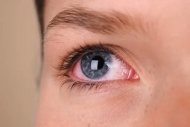 Las infecciones oculares más comunes